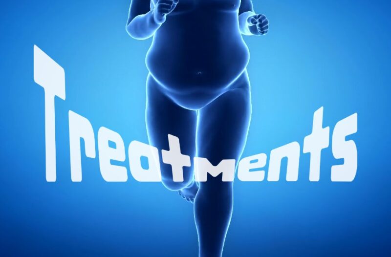 Pubic Fat Treatments